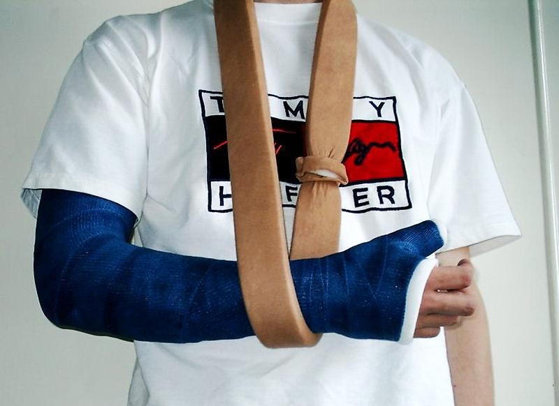 broken_arm